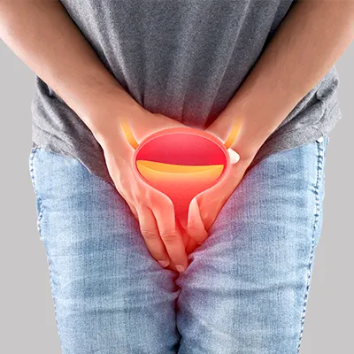 img-tratamiento-de-incontinencia-urinaria​-en-bogota-1-LCP